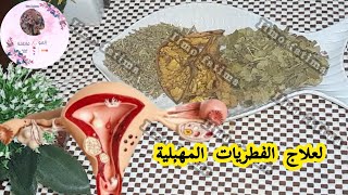 أقوى وصفة طبيعية التهابات المهبل🌺عند النساء و إلإفرازات المهبلية غير العادية💞 [upl. by Anawaj607]