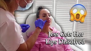 I Had My Lip Filler DISSOLVED [upl. by Smaoht]