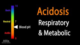 Acidosis Respiratory and Metabolic Animation [upl. by Theo]