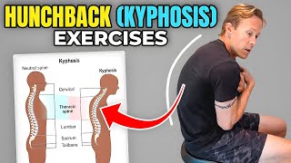 How to Improve Your MidBack Posture Thoracic Kyphosis Exercises [upl. by Ebenezer]