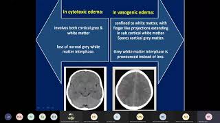 increased intracranial pressure [upl. by Niroc]