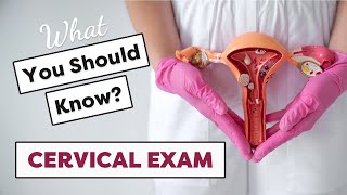 Understanding Cervical Exams During Labor [upl. by Veradi]