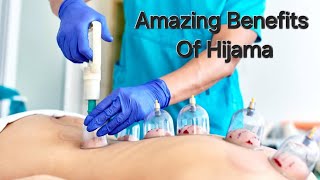 Discover the Ancient Healing of Hijama Cupping Therapy  By Shagufta Siraj [upl. by Donaldson]