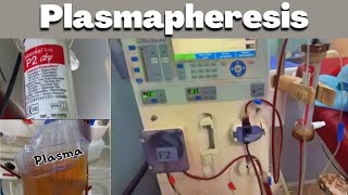 Plasmapheresis and its procedure explained in nepali [upl. by Zampino]