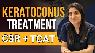 Keratoconus Treatment C3R TCAT C3R [upl. by Eedyak]