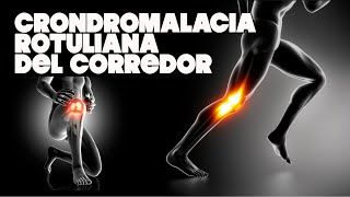 🏃 CONDROMALACIA ROTULIANA ➡ Motivos y Soluciones🦵 682 [upl. by Michelsen]