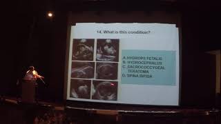 BASIC OBSTETRICS AND GYNAECOLOGY ULTRASOUND QUIZ [upl. by Bjorn]