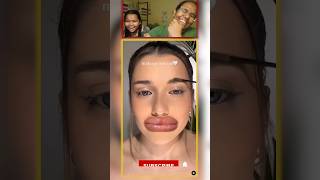 Lips surgery 👄comedy funnypictures makeup [upl. by Rissa]