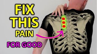 Fix Rhomboid Pain For Good Shoulder Blade Pain [upl. by Gilleod]