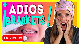 🎥𝐑𝐄𝐓𝐈𝐑𝐎 𝐝𝐞 𝐎𝐑𝐓𝐎𝐃𝐎𝐍𝐂𝐈𝐀 en 𝒗𝒊𝒗𝒐 Como se 𝗤𝗨𝗜𝗧𝗔𝗡 los BRACKETS y se ponen los RETENEDORES ORTODONCIA🔥 [upl. by Johnsten]