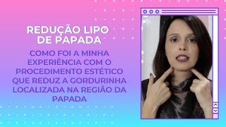 Minha experiência com a Lipo de Papada [upl. by Glennon75]