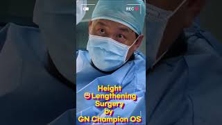 Height Lengthening by JongHo Ahn MD Gangnam Champion Orthopedic Surgery Hospital 강남챔피언 정형외과 안종호박사 [upl. by Welcome]