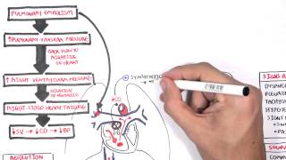 Pulmonary Embolism PART I Overview [upl. by Aisena]