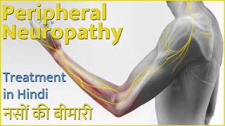 PERIPHERAL NEUROPATHIC PAIN IN HINDI what is peripheral neuropathy what can be done about it [upl. by Alford]