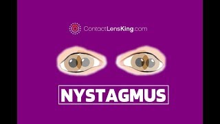 Nystagmus Eyes Explained  Involuntary Repetitive Eye Movement [upl. by Cary]