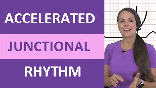 Accelerated Junctional Rhythm ECG Nursing EKG NCLEX Review Made Easy [upl. by Ozzy557]