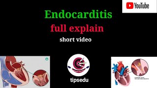 Endocarditis Pathophysiology signs and symptoms for nursing students endocarditis tipsedu [upl. by Pedroza513]