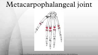 Metacarpophalangeal joint [upl. by Yesac]