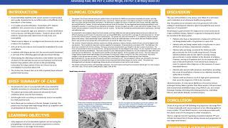 Drug induced acute interstitial nephritis [upl. by Simeon]