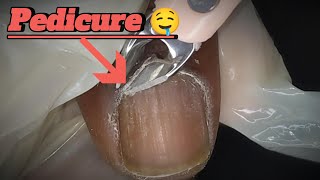 quotSatisfying Pedicure Transformation Deep Cleaning amp Nail Care Tipsquot [upl. by Lasala867]