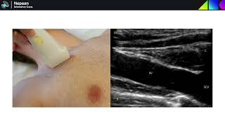 Vascular Ultrasound including Aorta  General US Revision Series [upl. by Perceval]