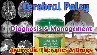 Cerebral Palsy Diagnosis amp Management II Ayurvedic Management of Cerebral Palsy [upl. by Navoj]