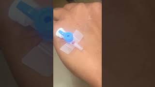 IV cannula insertiondocternursingtrendingforyouyoutubelovepopularviralvideoshortvideo [upl. by Edouard497]