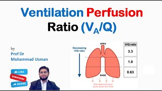 Ventilation Perfusion Ratio  VQ Ratio  VQ mismatch  Physiology of Respiration [upl. by Esinehc]