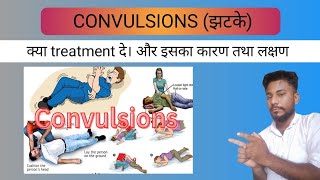 convulsions  झटके लगना का causes symptoms and treatment 🤷🤷 [upl. by Nylesor]