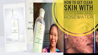 HOW TO USE GLYCERIN AND ROSEWATER FOR SKIN TONINGHOW TO GET CLEAR SKIN [upl. by Ned]