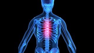 Thoracic Back Pain Explained by a Top Pain Physician in Las Vegas Nevada [upl. by Ihcehcu]