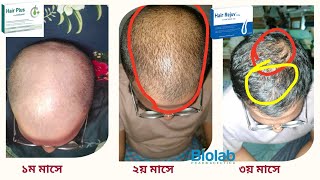 শুধু Hair Plus ৩ মাস খেতে ফলাফল দেখুন [upl. by Llennol]