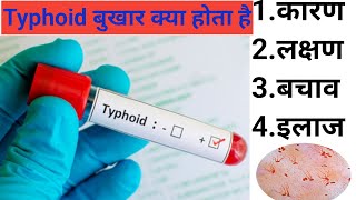 typhoid fever  typhoid ke lakshan 90डॉक्टर बेवकूफ बनाते है typhoid fever treatment typhoidfever [upl. by Esdnil399]