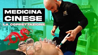 Visita osteopatica con coppettazione ad un professionista del Padel Italiano [upl. by Jurgen]