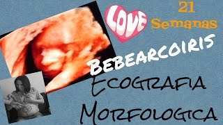 Ecografia morfologica del bebe 21 semanasmama [upl. by Euton]