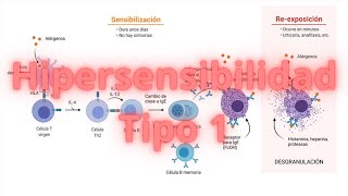 Hipersensibilidad tipo 1 explicada [upl. by Alliehs]