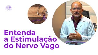 Entenda a Estimulação do Nervo Vago  VNS [upl. by Alcine]