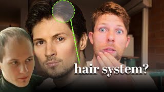 Super Famous Billionaire Is Wearing a HAIR SYSTEM [upl. by Reilly598]