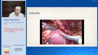 Triple Neurectomía con asistencia robótica Dolor inguinal crónico [upl. by Anahoj]