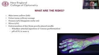 Lecture Fluorescein Angiography [upl. by Aryamo624]