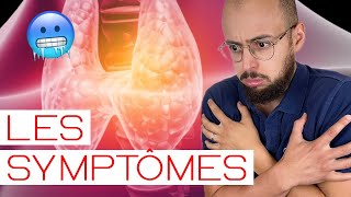 HYPOTHYROIDIE  les symptômes [upl. by Lizzy]