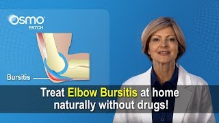 Elbow Bursitis Relief  Reduce swelling amp pain naturally Olecranon bursitis [upl. by Ramonda]