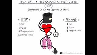 ICP and the ECG [upl. by Nerek]