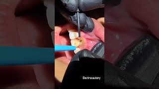 Want to improve the appearance of your smile Watch this video dentalhealth smilecorrecting [upl. by Grannia]