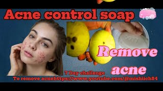 How too remove your Acne Acne control soap acne km krny ka treeka Best soap for pimples [upl. by Fulks]