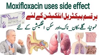 moxifloxacin 400 mg uses in urdu moxifloxacin 400 mg  Mofest 400mg  X gen 400mg  Avelox 400mg [upl. by Auhsuoj967]