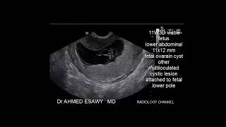 CASE REVIEW advanced fetal 2D 3D 4D ultrasound part2 [upl. by Metcalf]