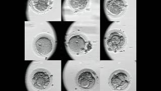 Evolución embriones FIV Embryoscope [upl. by Zamora27]