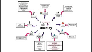 Obesity  OSCE [upl. by Assiluy670]