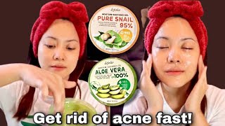 How to use Aloe Vera Gel  Esfolio Aloe Vera Soothing Gel  Pure Snail 95  Get Rid of Acne Fast [upl. by Scibert]